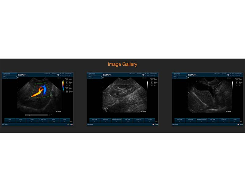 10. U50 VET Veterinary Portable Ultrasound (1)