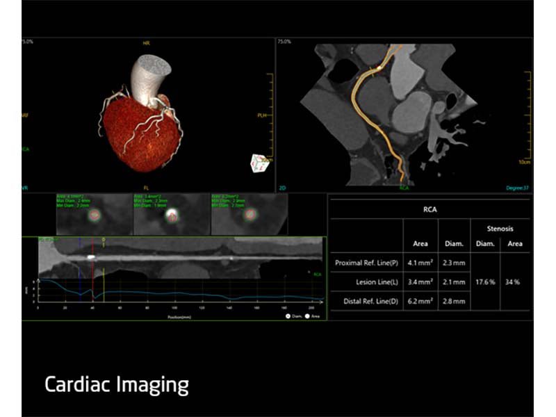 Neusoft NeuViz ACE 64e CT