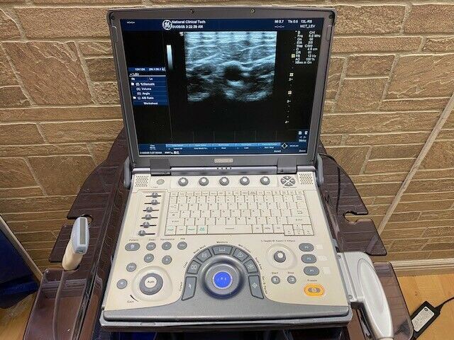 GE LogiQ E portable ultrasound with cardiac phased array probe cart-Warranty #