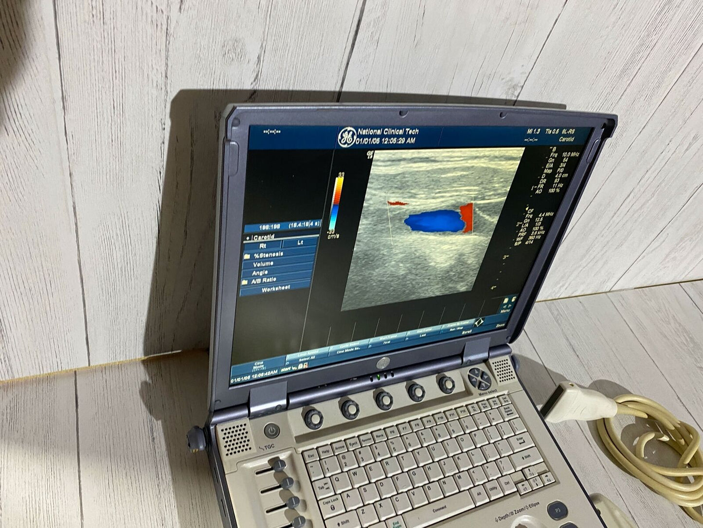 Ge Logic E portable Ultrasound machine with one linear array prone L8-8S -2006 #