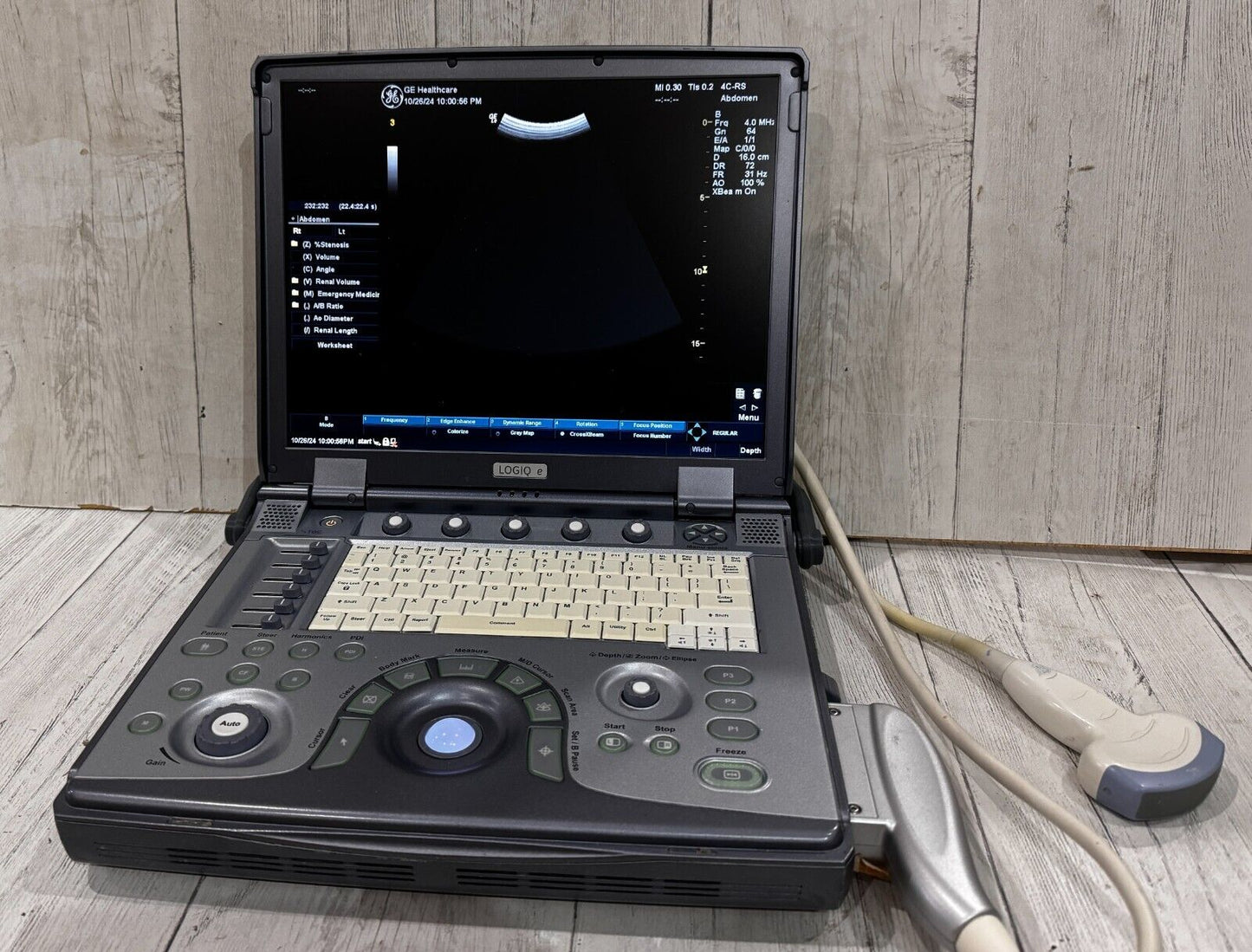 GE Logiq E portable ultrasound 2011 with 4C-Rs Abdominal Probe #