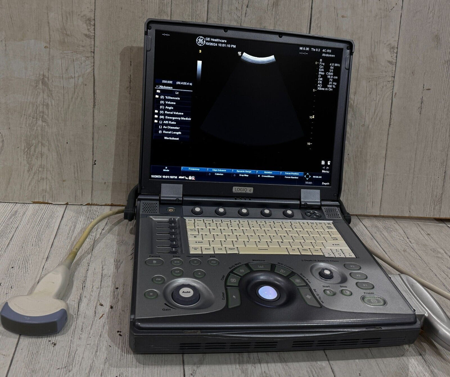 GE Logiq E portable ultrasound 2011 with 4C-Rs Abdominal Probe #
