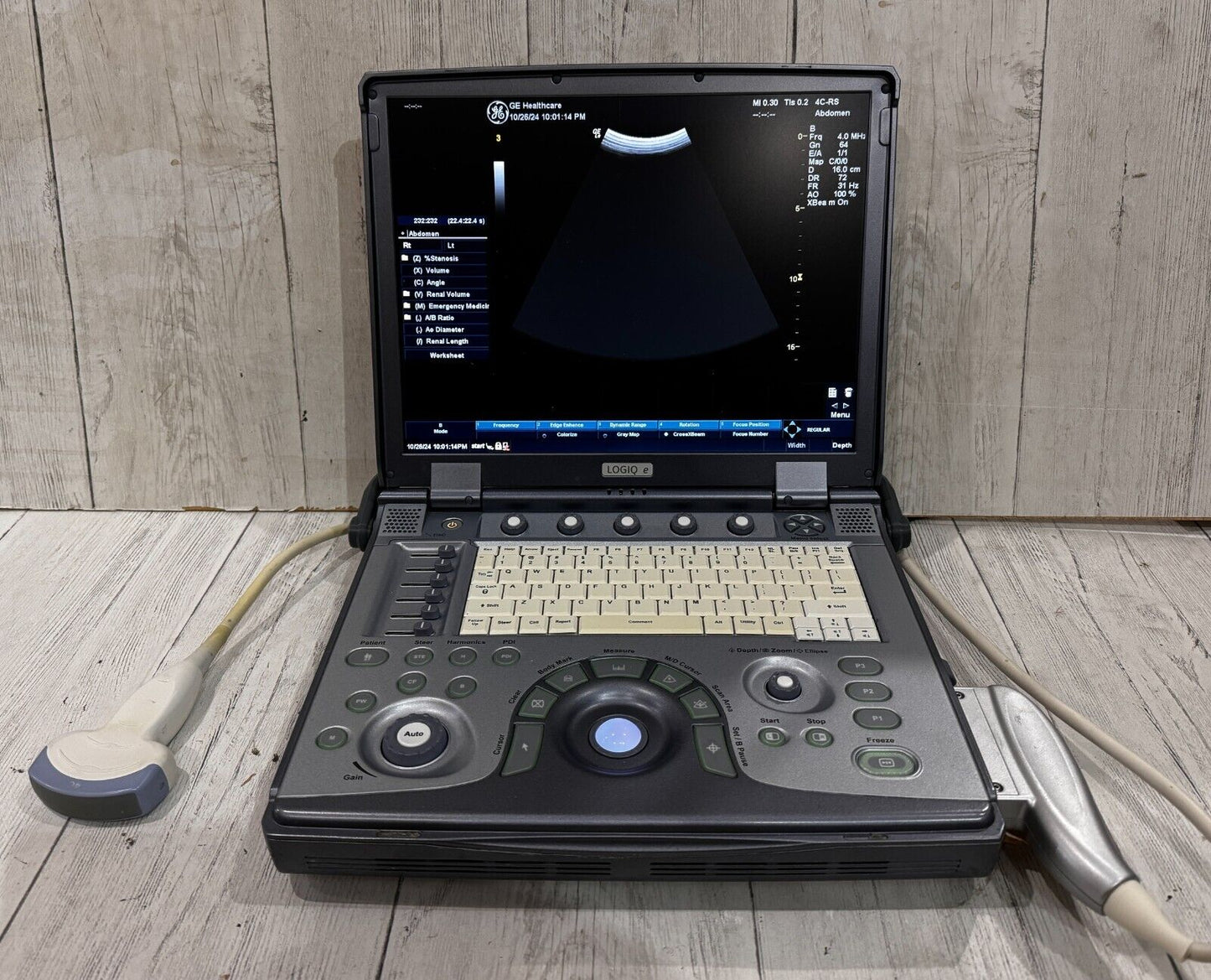 GE Logiq E portable ultrasound 2011 with 4C-Rs Abdominal Probe #