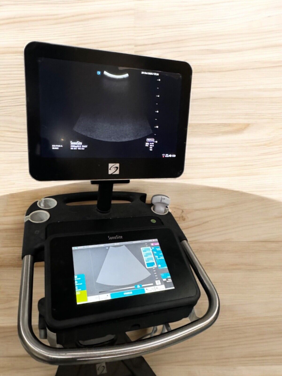Sonosite X-porte Ultrasound with one C60XP Abdominal Probe #