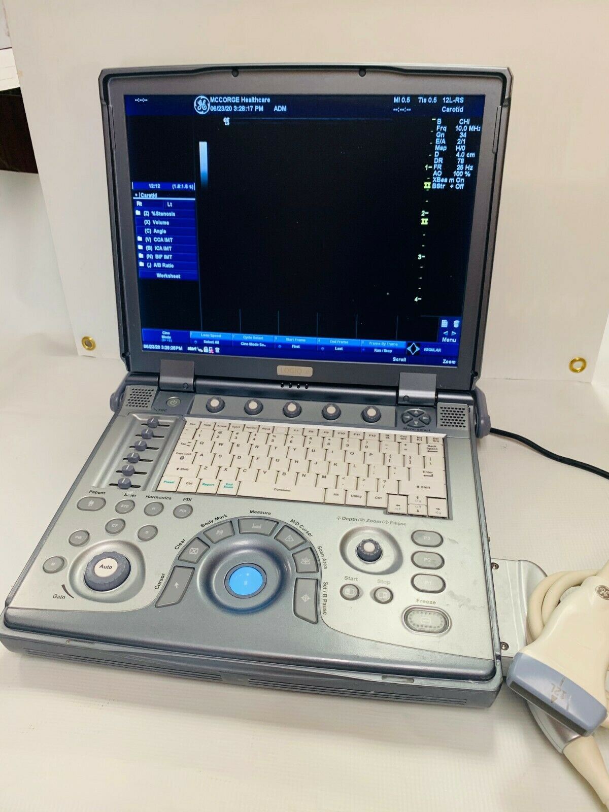 GE Logiq E Color Ultrasound Scanner, 3 probes Cardiac,Linear, convex 2011 #