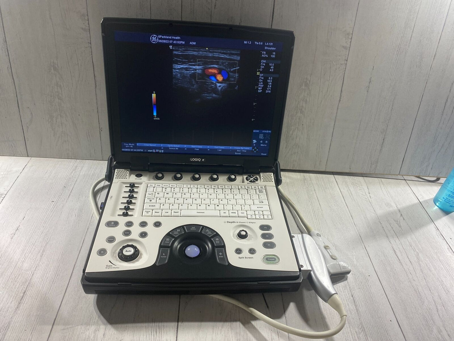 GE LOGIQ E Next Generation Ultrasound machine & Probe -L4-12T DOM 2014 R8.0.4 #