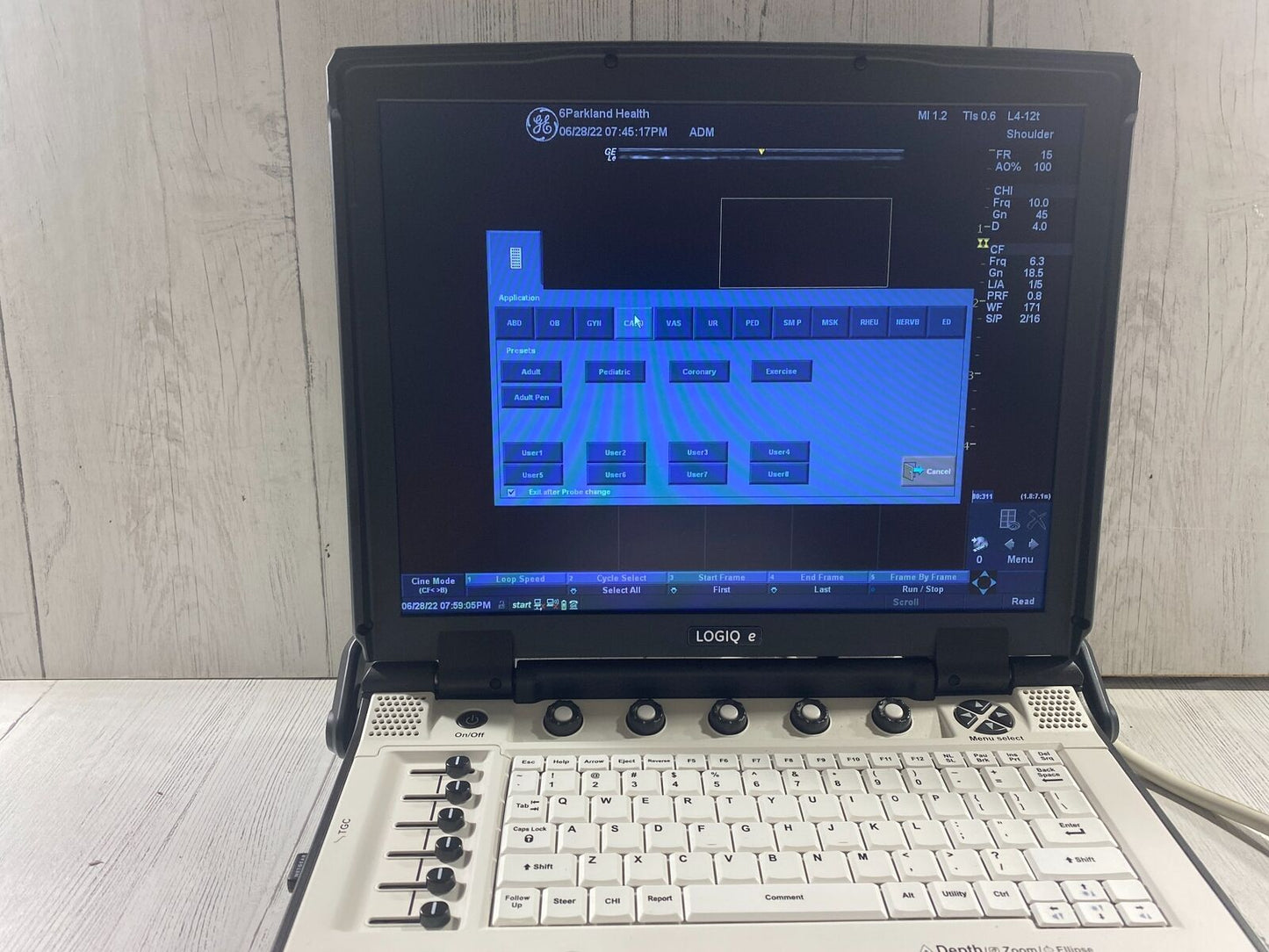 GE LOGIQ E Next Generation Ultrasound machine & Probe -L4-12T DOM 2014 R8.0.4 #