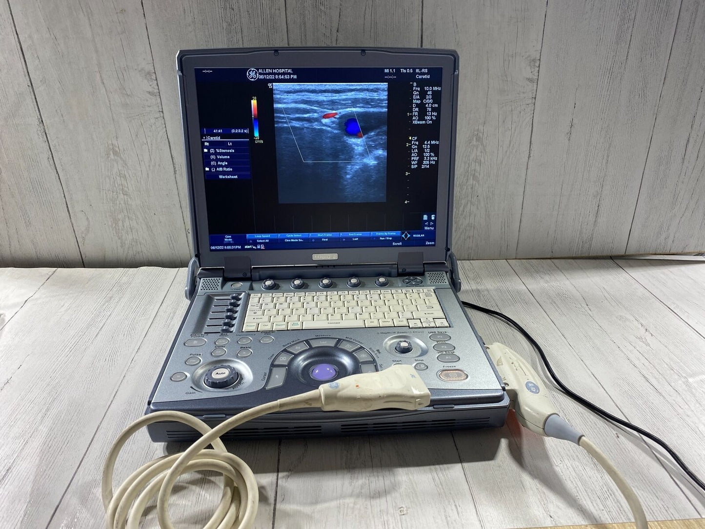 GE LogiQ E portable ultrasound #