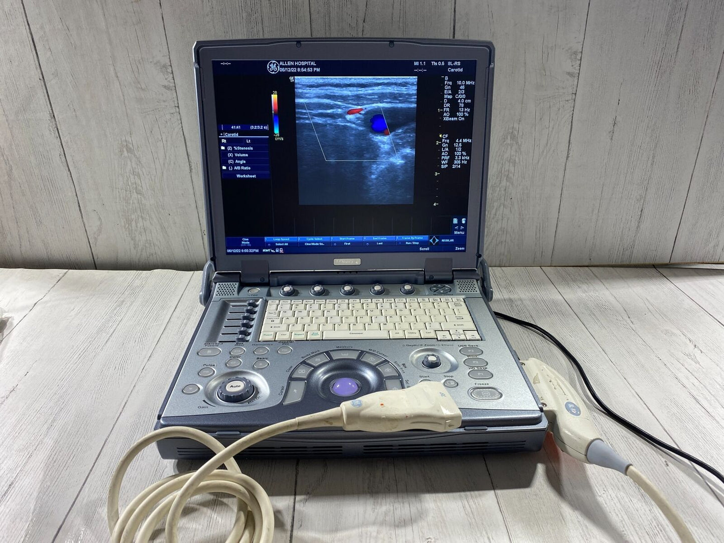 GE LogiQ E portable ultrasound #