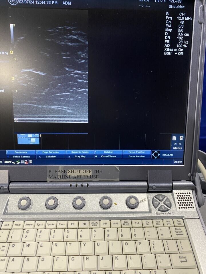 GE Logiq E Ultrasound System with two probes: 12L and 4C Probes- 2011 #