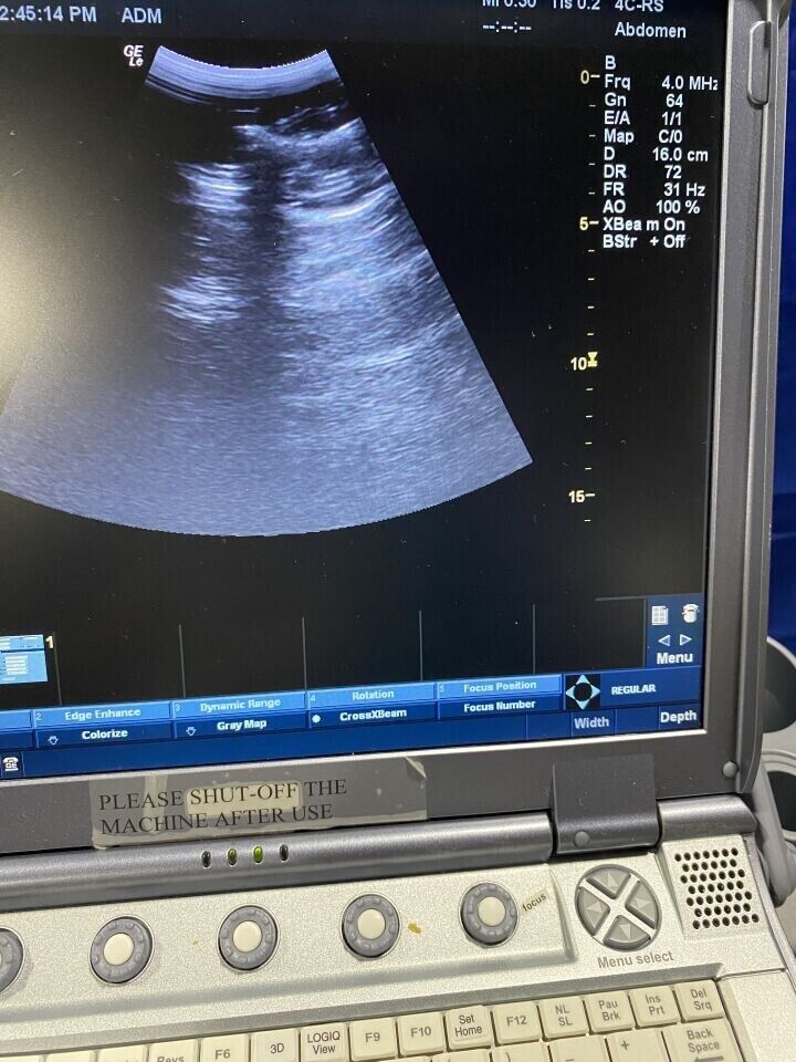 GE Logiq E Ultrasound System with two probes: 12L and 4C Probes- 2011 #