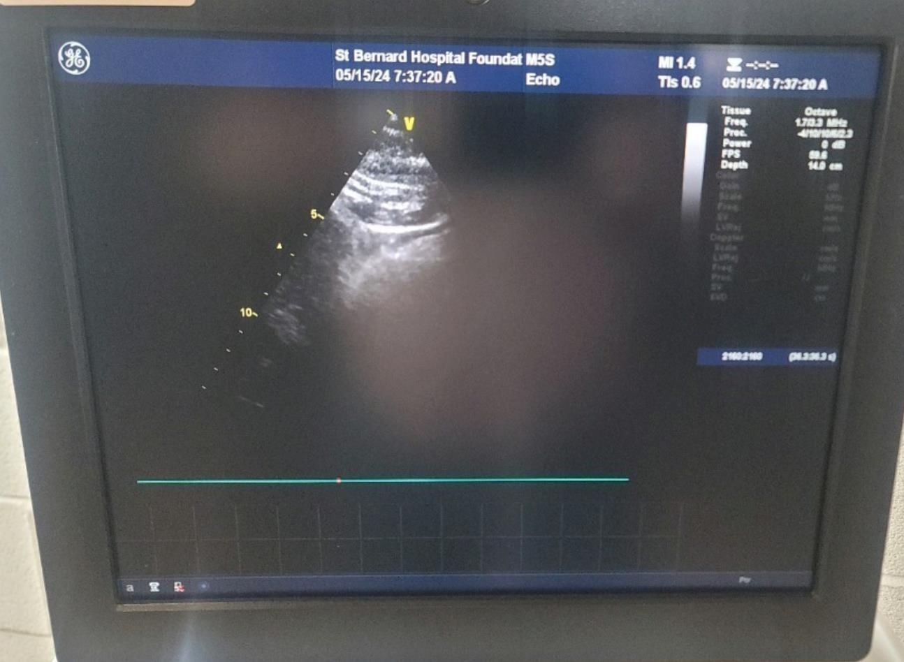 GE VIVID E9 Ultrasound with one Cardiac Probe (M5S-D) 2011 #