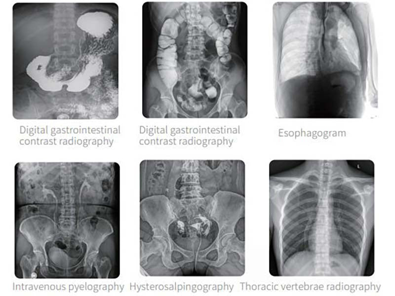Perlove PLX8500 Series Multifunctional Dynamic Digital radiography (1)