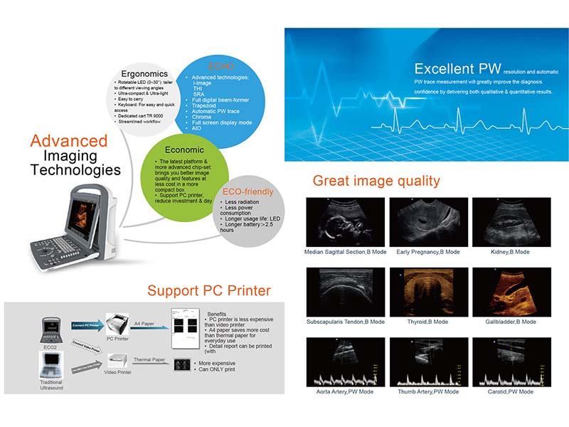 Chison ECO2 Portable B&W Ultrasound
