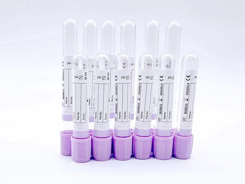 AODEKANG 1-10ml EDTA Tube Vacuum Blood Collection Tube (1)