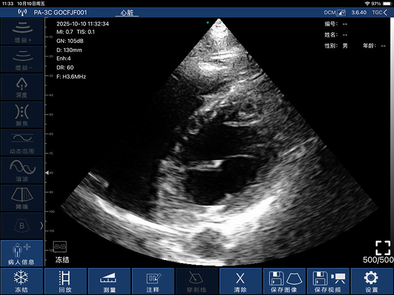 Global Healthcare Medical palm-sized wireless phased array ultrasound scanner with 192-element probe for cardiac and point-of-care imaging
