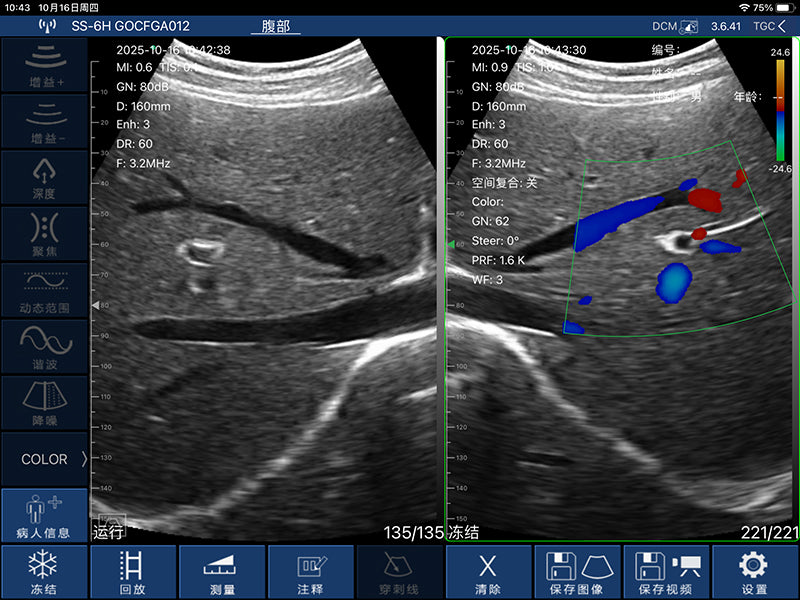 Global Healthcare Medical palm-sized wireless convex ultrasound scanner with 192-element probe for abdominal and point-of-care imaging