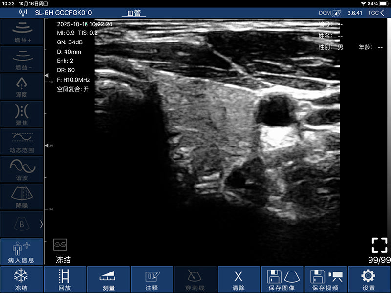 Global Healthcare Medical palm-sized wireless linear ultrasound scanner with 192-element probe for high-resolution superficial imaging