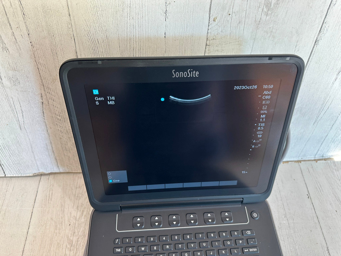 Sonosite Edge II Portable Ultrasound Color Package DICOM #