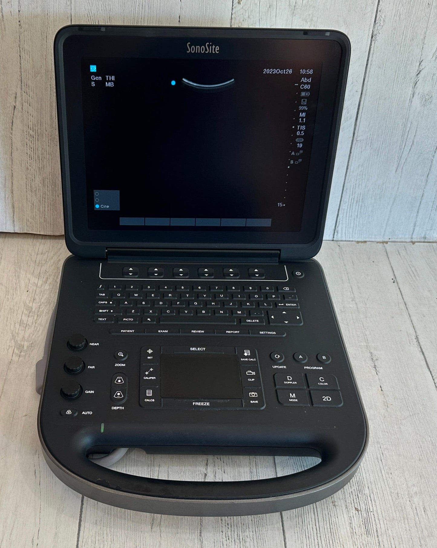 Sonosite Edge II Portable Ultrasound Color Package DICOM #