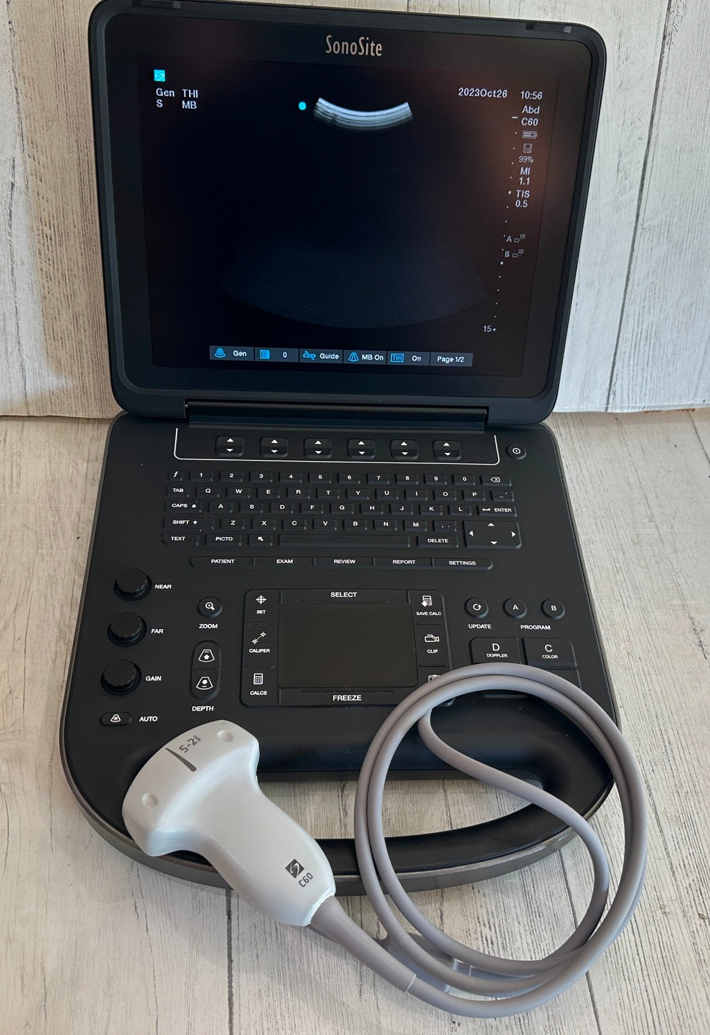 Sonosite Edge II Portable Ultrasound Color Package DICOM #
