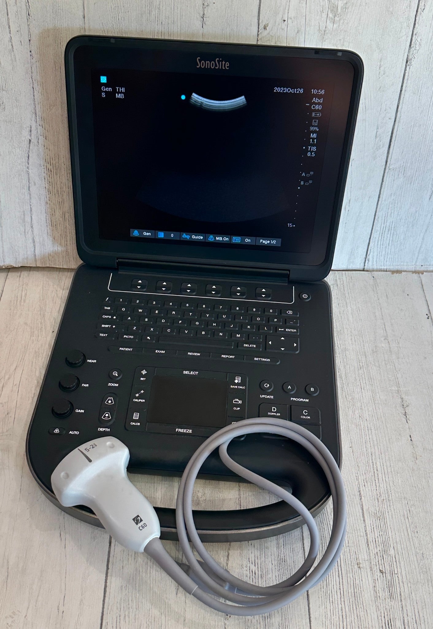 Sonosite Edge II Portable Ultrasound Color Package DICOM #