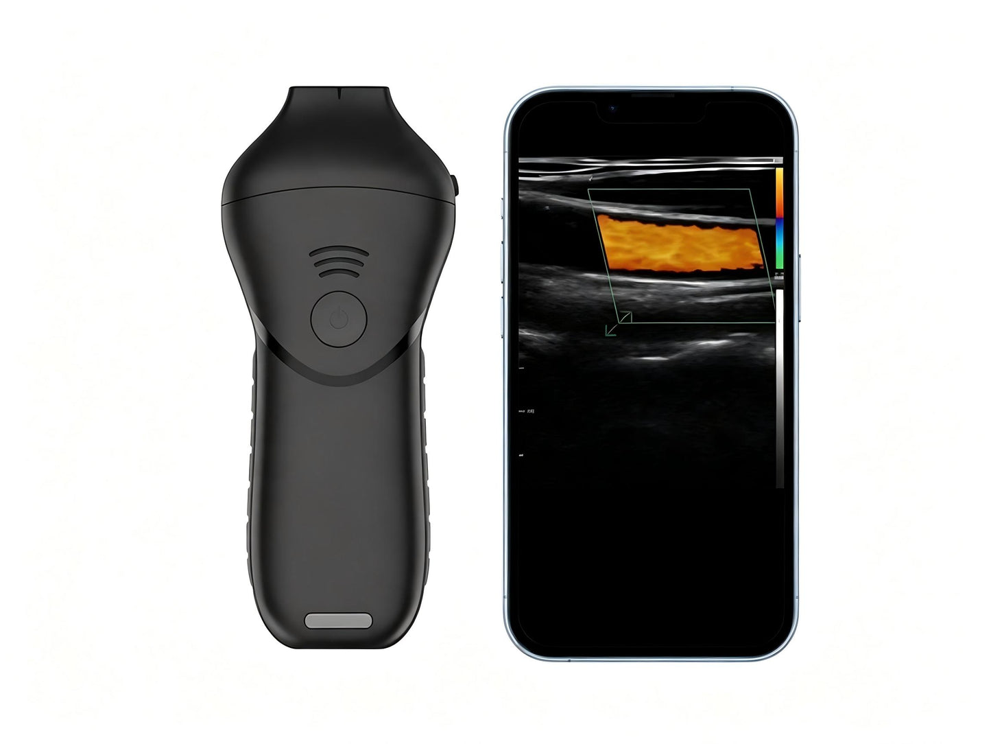 High-Frequency Linear Ultrasound Probe | 16-20 MHz Wireless Aesthetic Imaging for Facial Injections