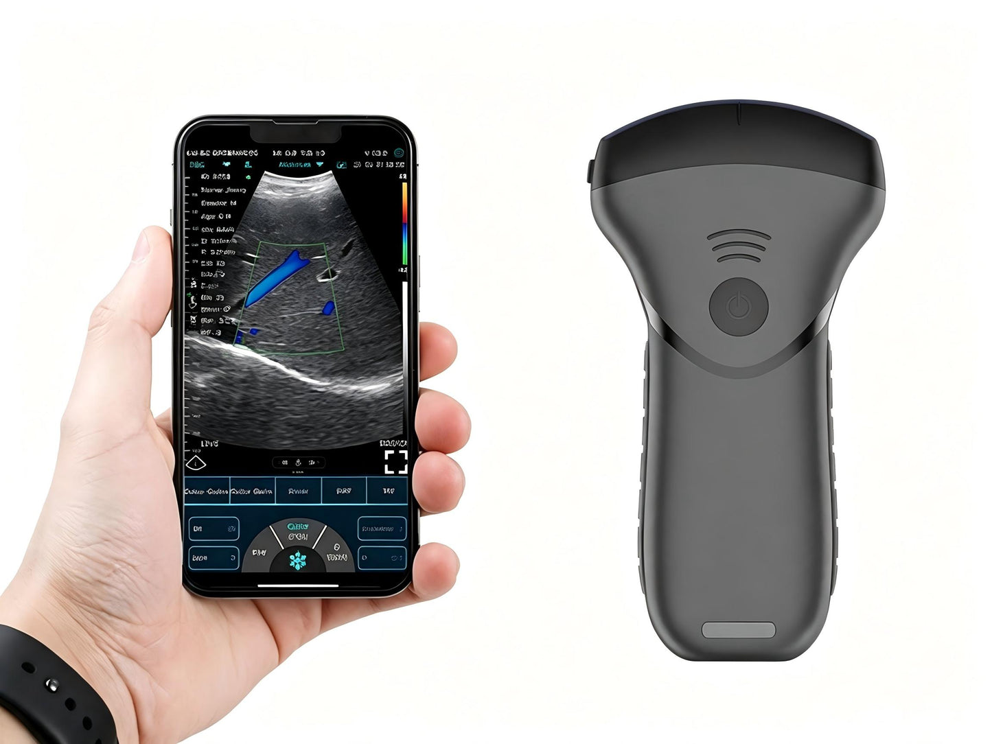 USB & WiFi Pocket Ultrasound | Wireless Convex Probe for Point-of-Care Imaging