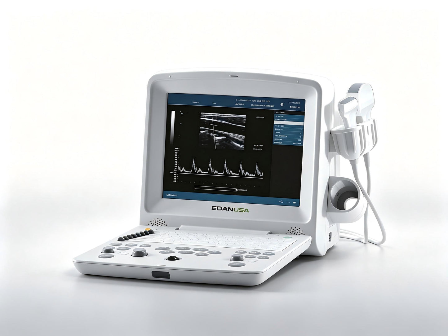 EDAN DUS 60 portable digital ultrasound system with 12.1-inch display and convex transducer