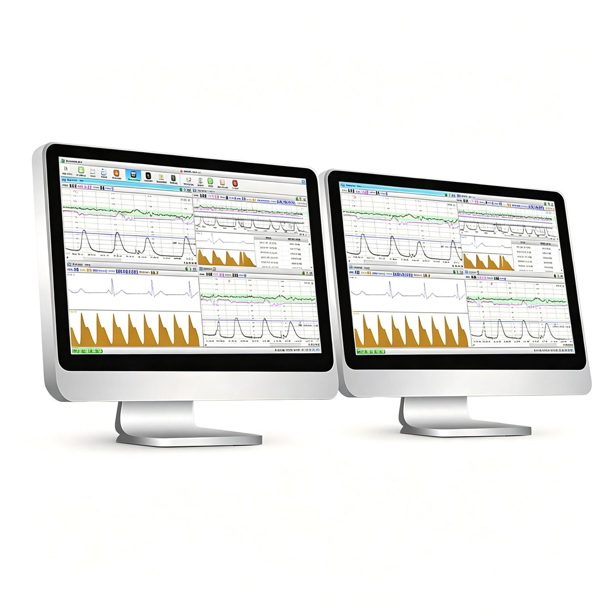 EDAN MFM-CNS Lite central monitoring system with PC-based software for up to six bedside monitors