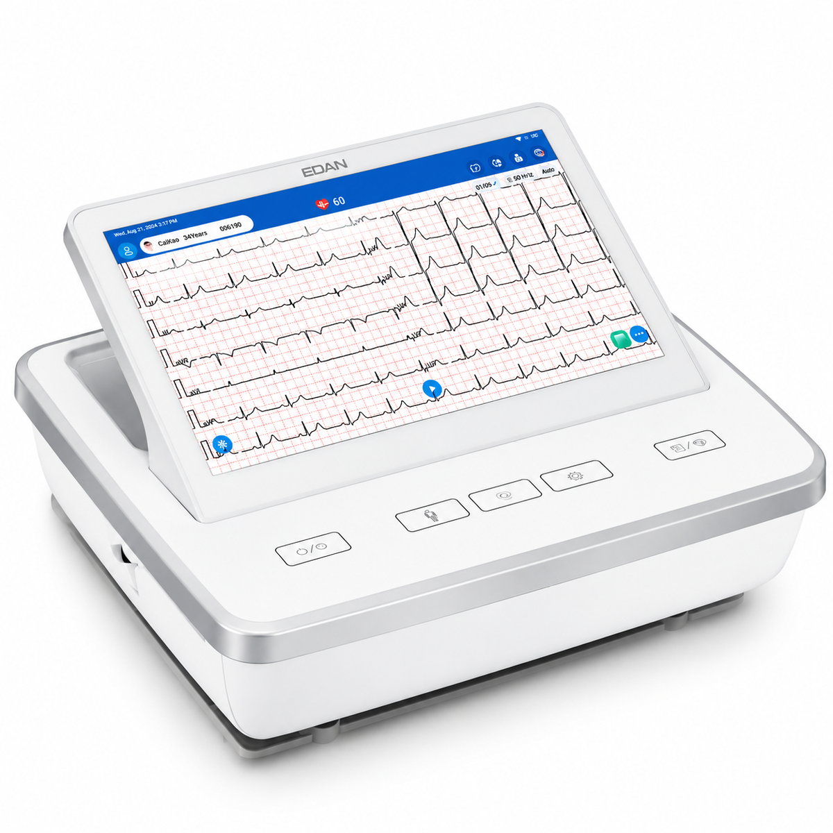 EDAN SE-1202E 13.3-inch touchscreen 12-channel ECG workstation with CardiSync 18 calculated 18-lead analysis, 160 kHz pacemaker detection and 10,000 ECG storage for advanced cardiac diagnostics