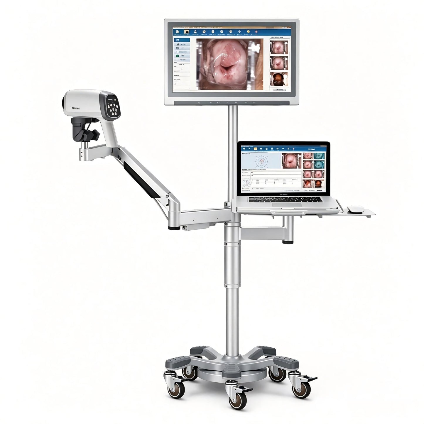 EDAN C6A Video Colposcope