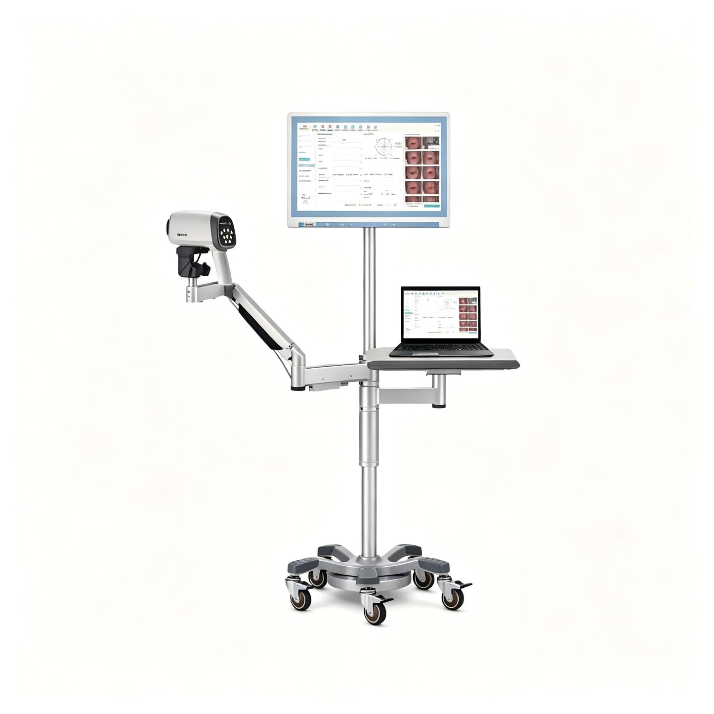 EDAN C6 HD video colposcope with LED lighting and high-definition camera for cervical examination