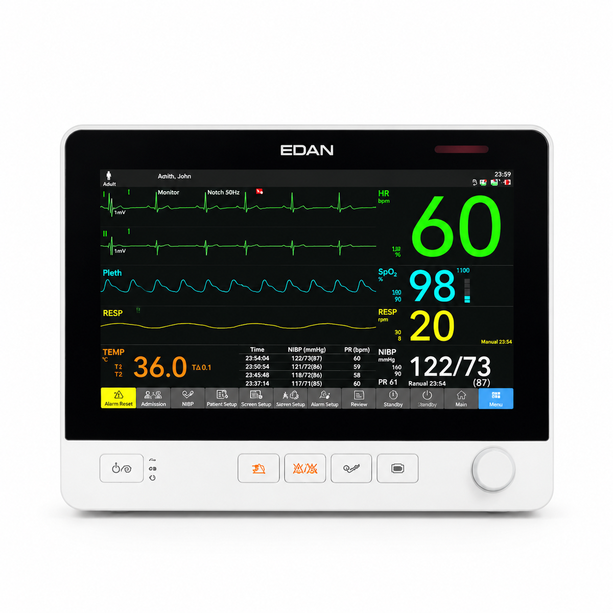 EDAN UX10 10.1-inch IPS touchscreen compact patient monitor with ECG, SpO2, NIBP and optional sidestream CO2 for hospital wards and transport