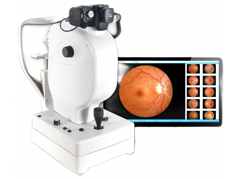 GHM-660A Desktop Fundus Camera #