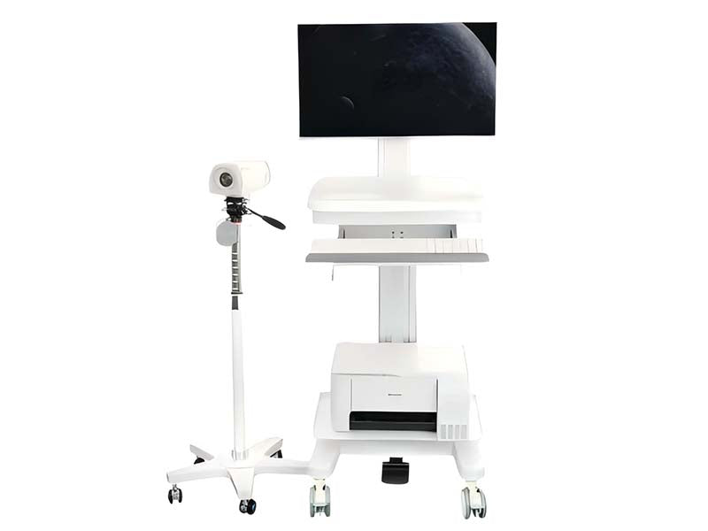 GHM-SY01 Digital Electronic Colposcope#