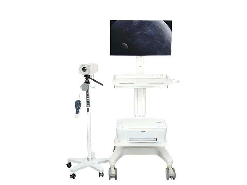 GHM-SY02 Digital Electronic Colposcope#