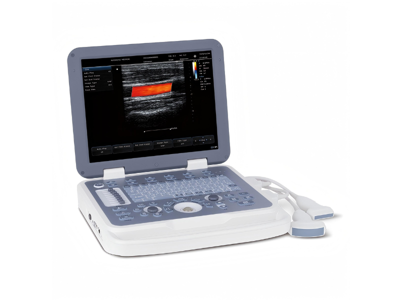GHM30 Color Doppler Portal Ultrasound#