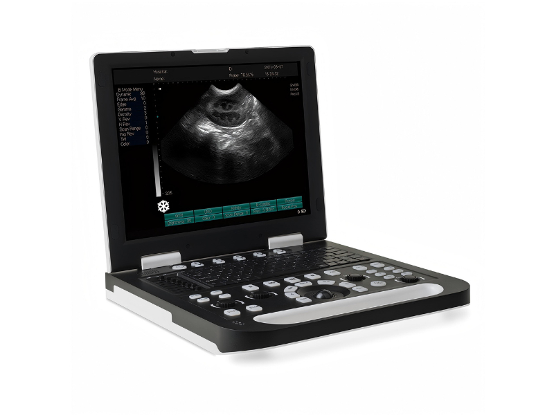 GHM60 Portal B&W Ultrasound#