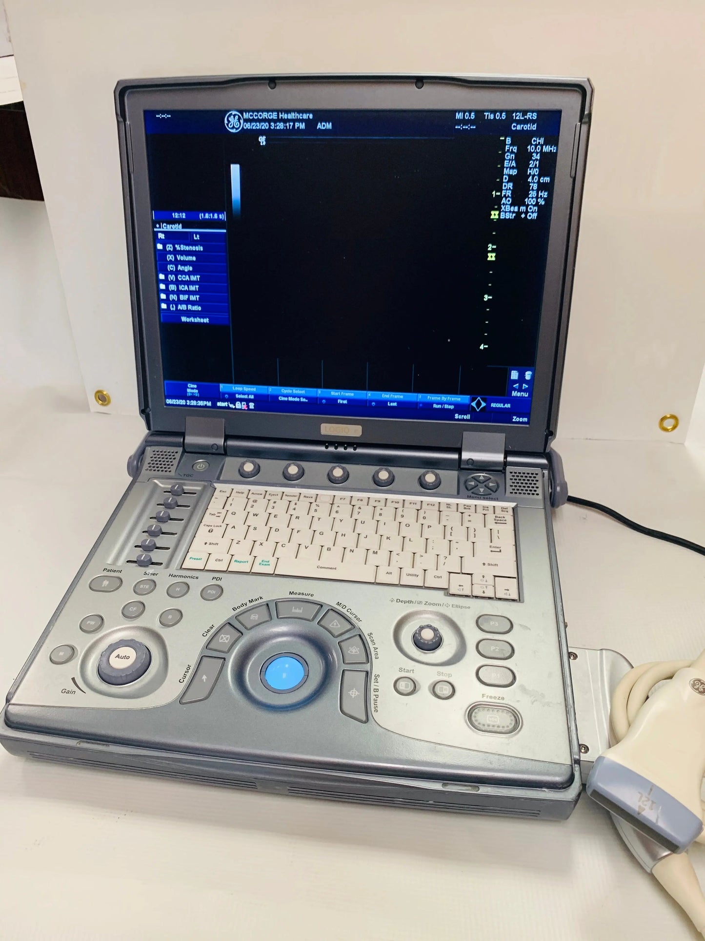 GE Logiq E Ultrasound with 3 probes #