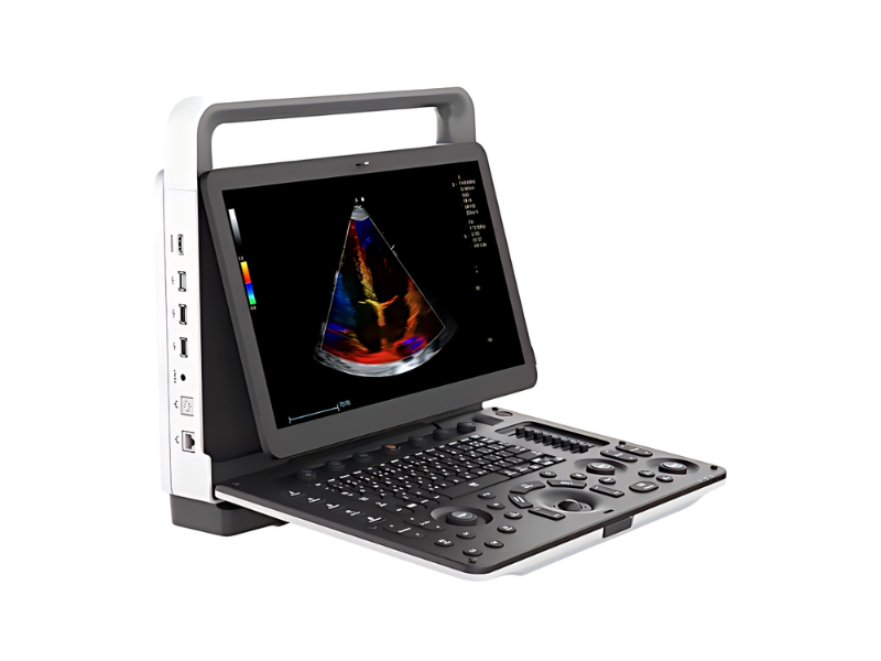 M30 Portable Color Doppler Ultrasound System