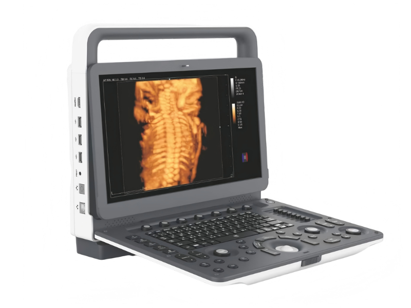M5 Portable Full Digital Color Doppler Ultrasound #