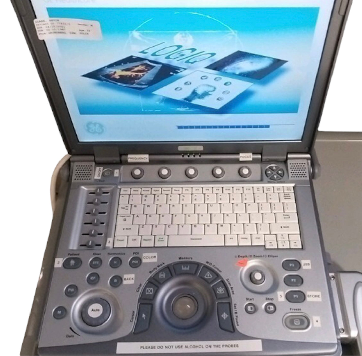 GE LOGIQ E Portable Ultrasound with 12L Probe and Trolley #