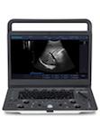 SonoScape A6V Expert E1V Vet Ultrasound #