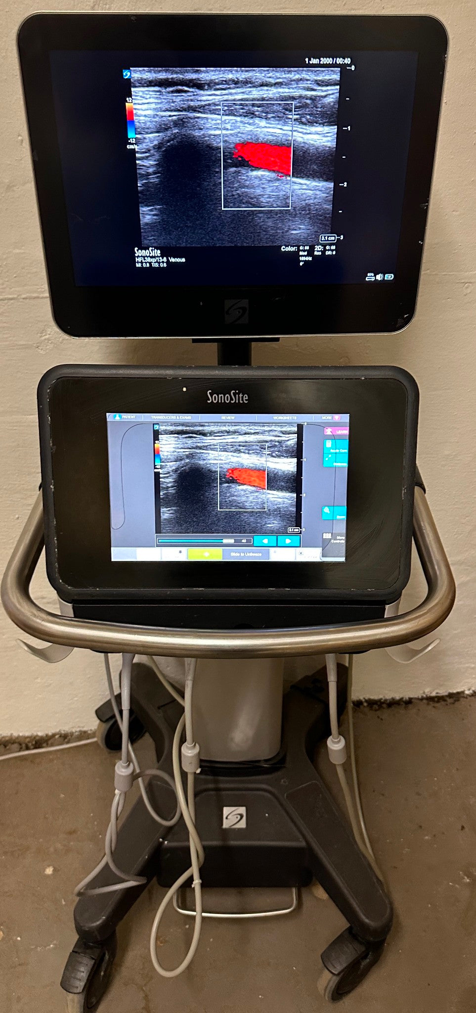 Sonosite X-Porte Ultrasound without probes manufactured 2021 #