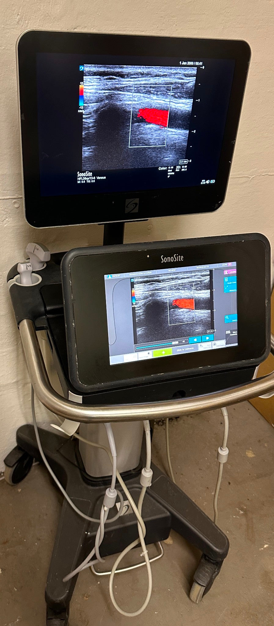 Sonosite X-Porte Ultrasound without probes manufactured 2021 #