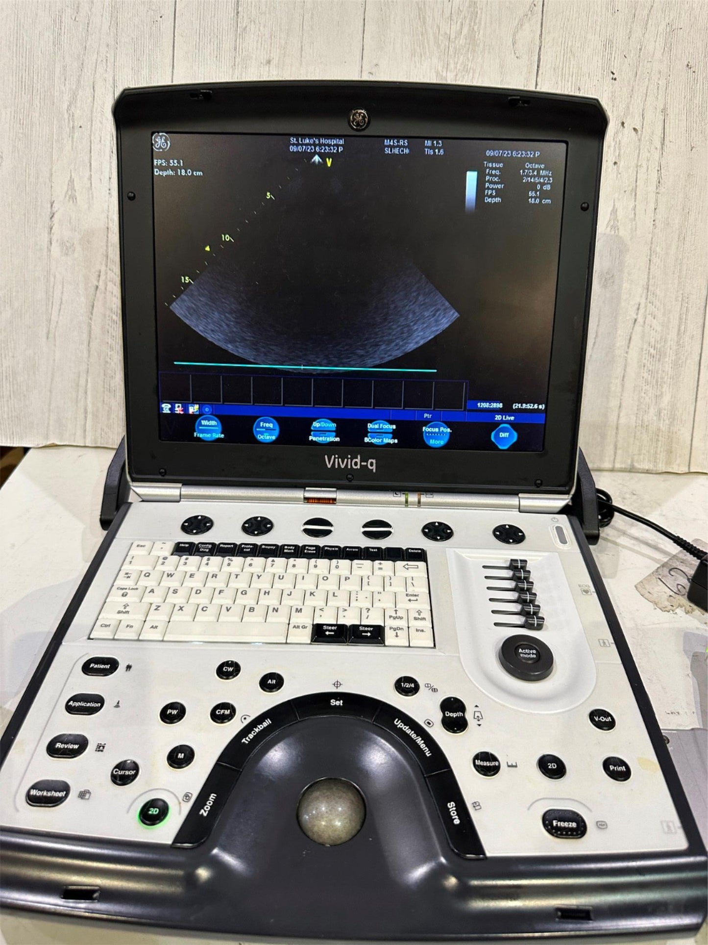 GE VIVID Q PORTABLE ULTRASOUND MACHINE BT12 -2015 #