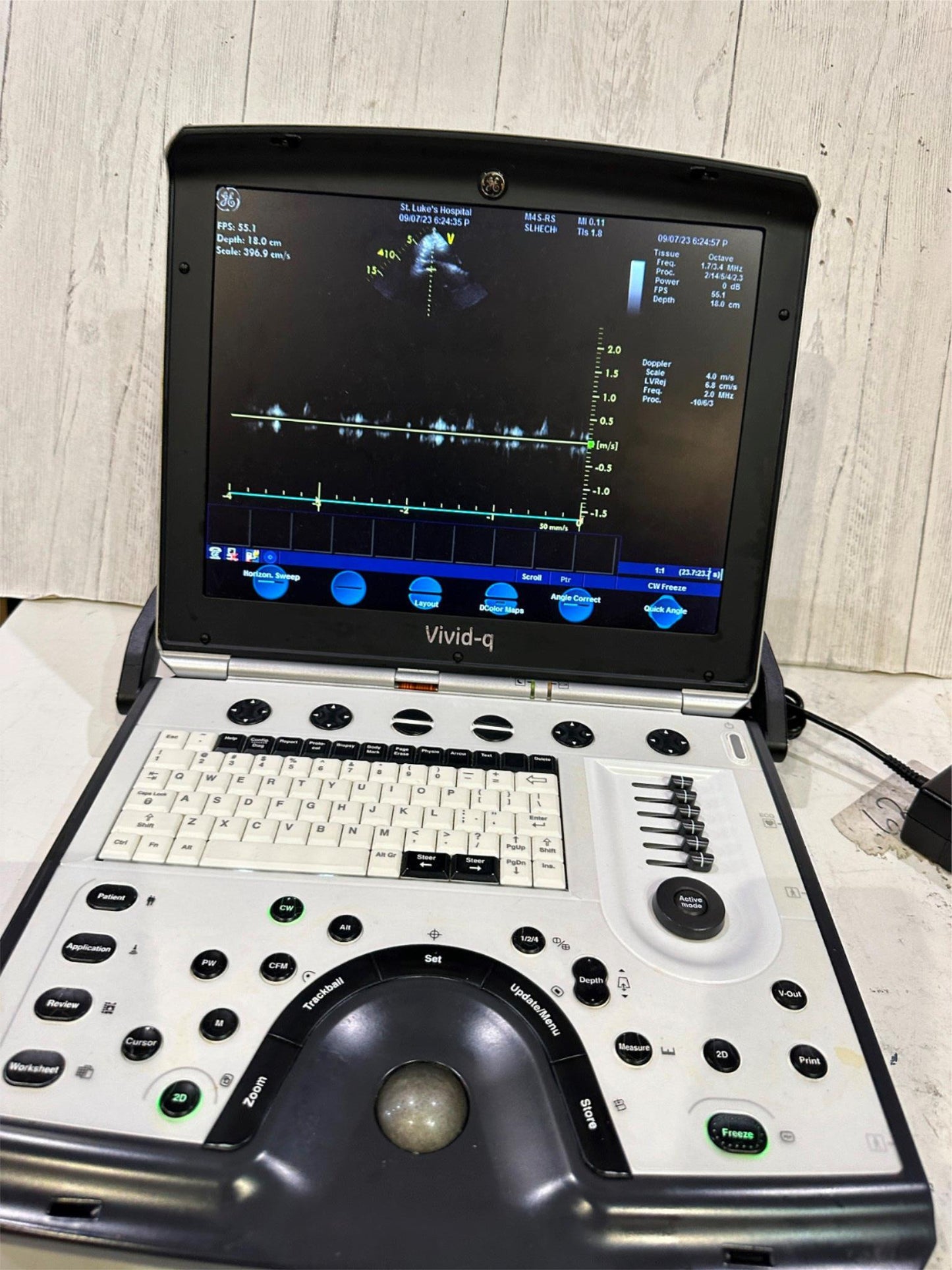 GE VIVID Q PORTABLE ULTRASOUND MACHINE BT12 -2015 #