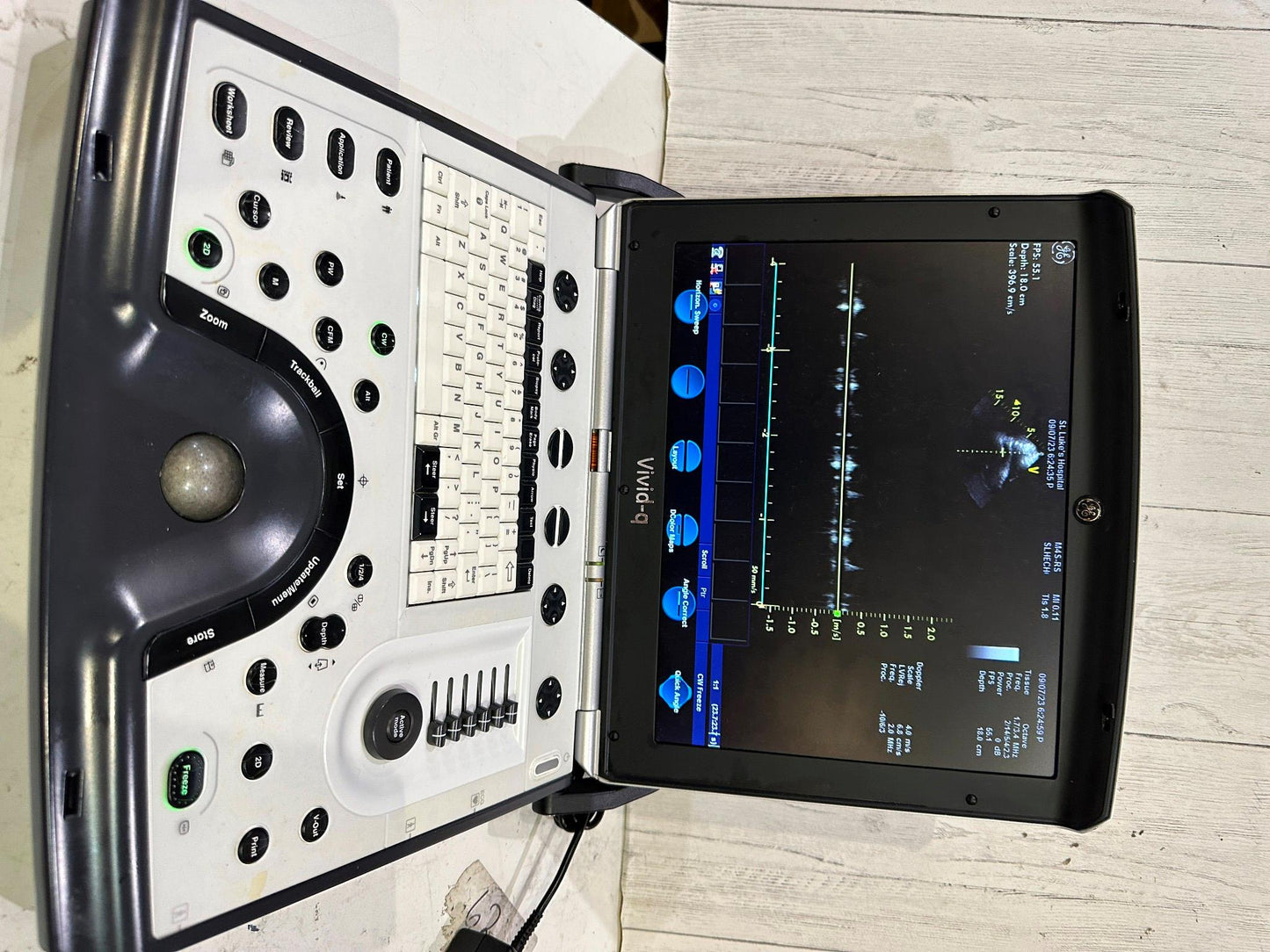 GE VIVID Q PORTABLE ULTRASOUND MACHINE BT12 -2015 #