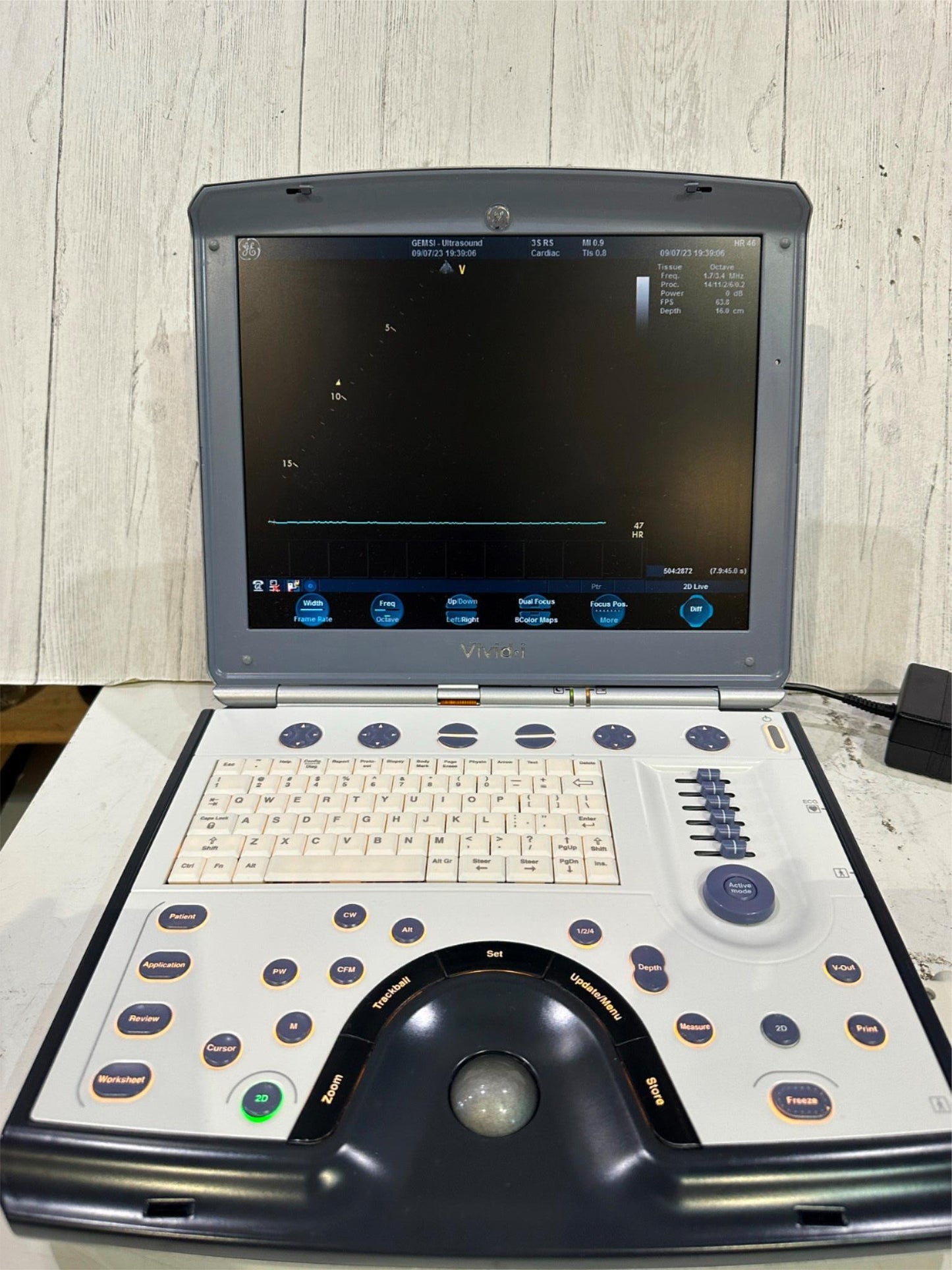 BT12 GE VIVID I PORTABLE ULTRASOUND MACHINE &3S -RS PROBE 2007, ALL OPTIONS #